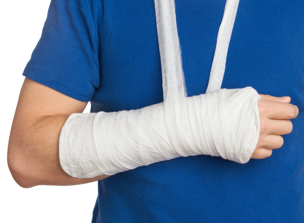 Arm injury wrapped in cast and sling